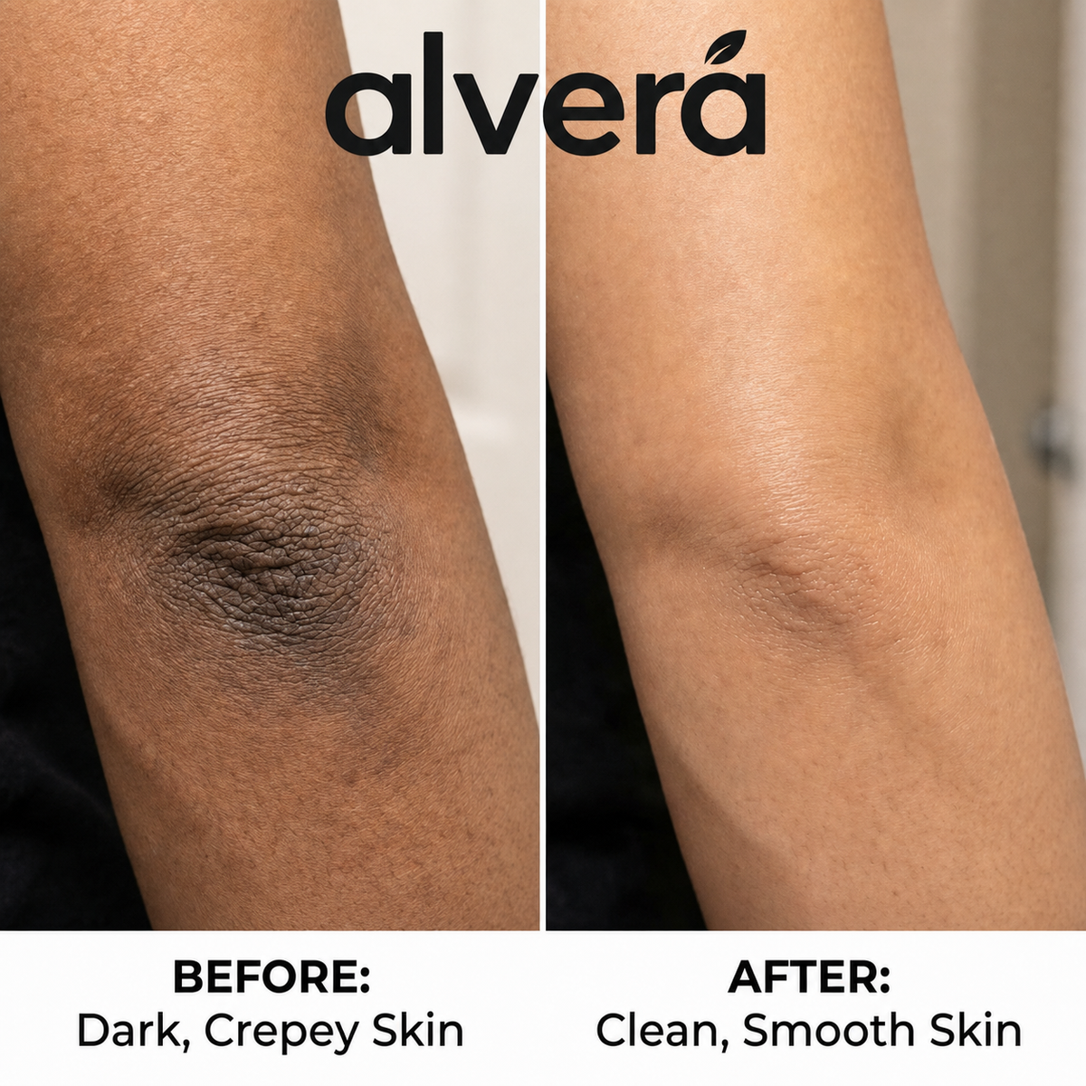Kojic Acid Turmeric spray - Dark Spot Formula