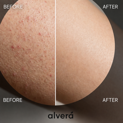 Kojic Acid Turmeric spray - Dark Spot Formula